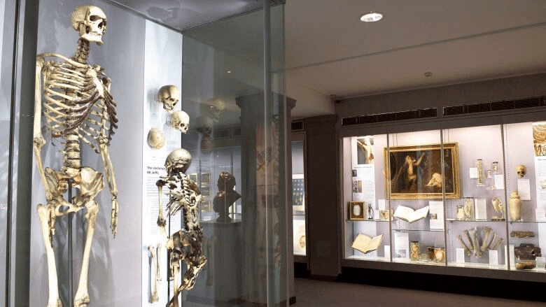 Charles Byrne’s bones on display at the Hunterian Museum 